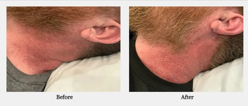 Before and after photos of DYE VL in Powell, WY.