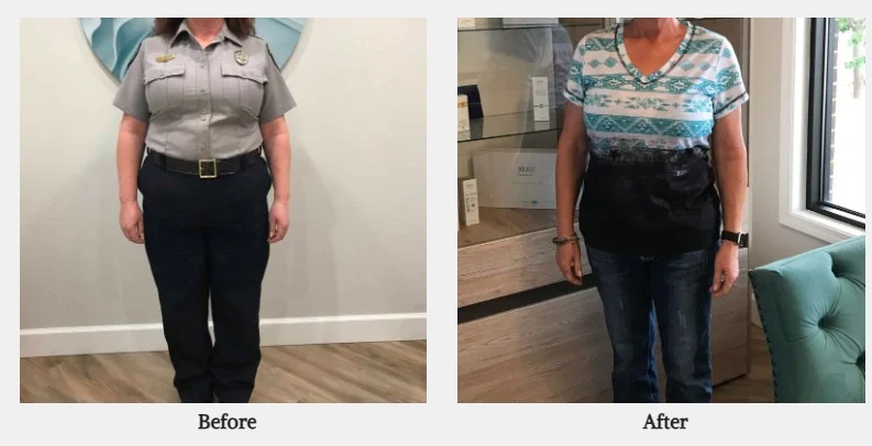 Weight loss before and after results in Powell, WY