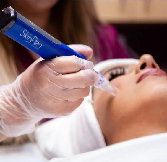 Gloved professional uses a SkinPen device for microneedling on a patient’s arm in Powell, WY.