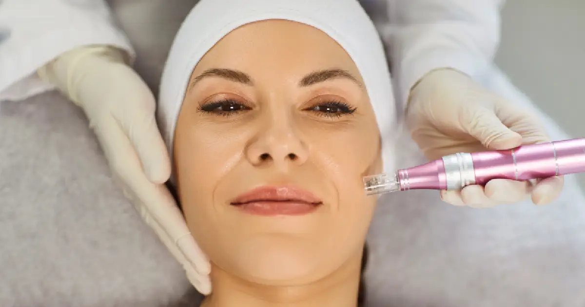 Women Receiving SkinPen Microneedling in Powell, WY